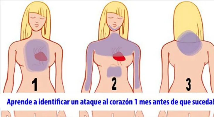 Aprende a identificar un ataque al corazón 1 mes antes de que suceda!
