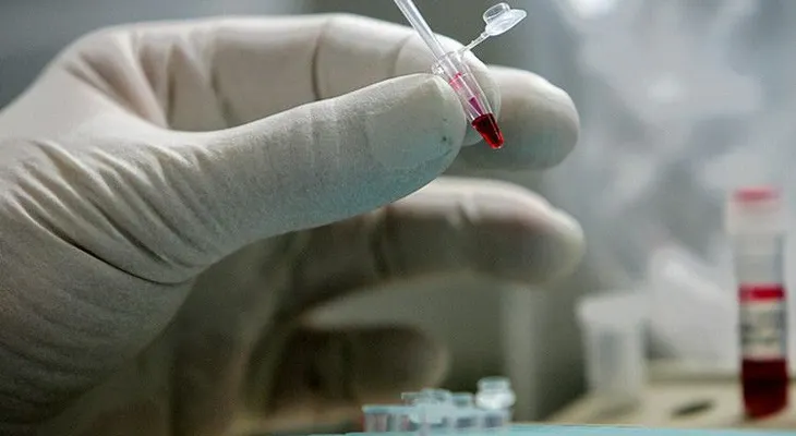 Los científicos alertan sobre un nuevo virus mortal que amenaza al mundo