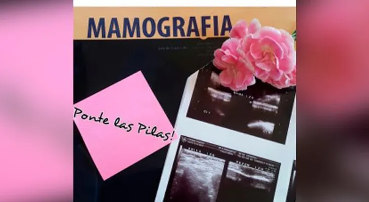 Iamdra Fermín muestra prueba de mamografía