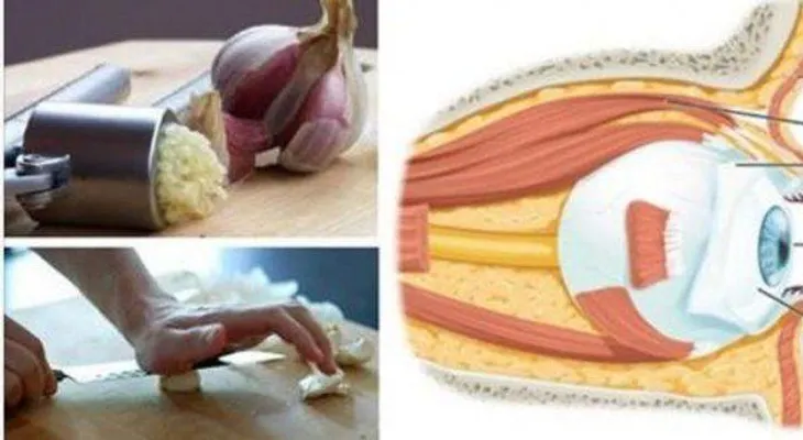 Cero gafas y cirugías: como usar el ajo para recuperar la visión
