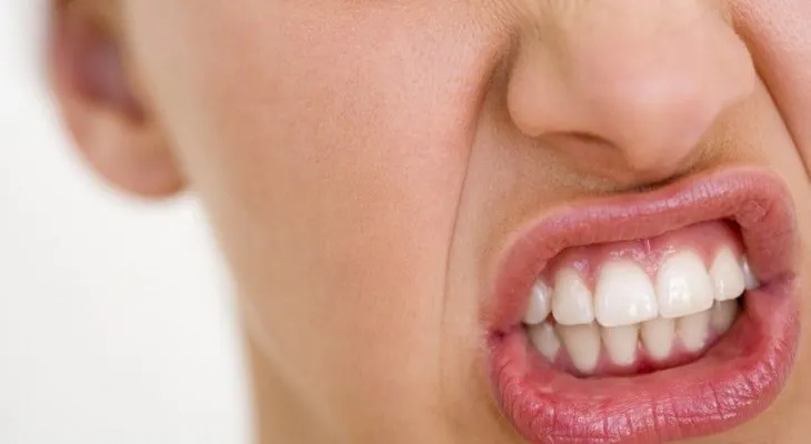 Remedios Naturales para Tratar El Bruxismo, Enemigo Silencioso de tu Sonrisa