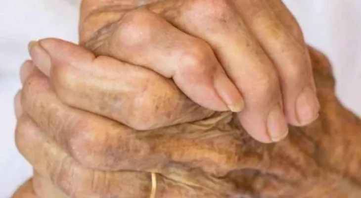 Las "manchas de la edad" normalmente no requieren tratamiento