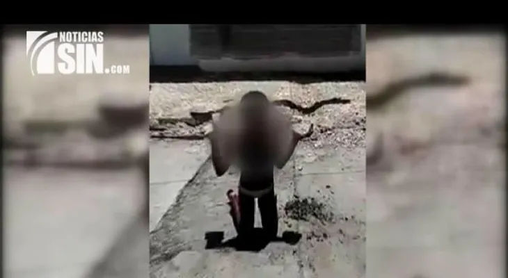 Niña castigada con blocks y bajo el sol por su madre está en CONANI