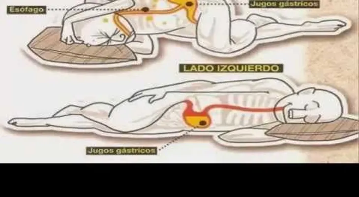 Es muy importante saberlo; mira lo que pasa en tu cuerpo cuando duermes de tu lado izquierdo