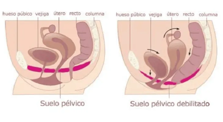 Suelo pélvico débil y 7 ejercicios simples para fortalecerlo