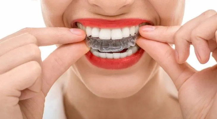 La ortodoncia invisible, alternativa a los brakets (Audio)