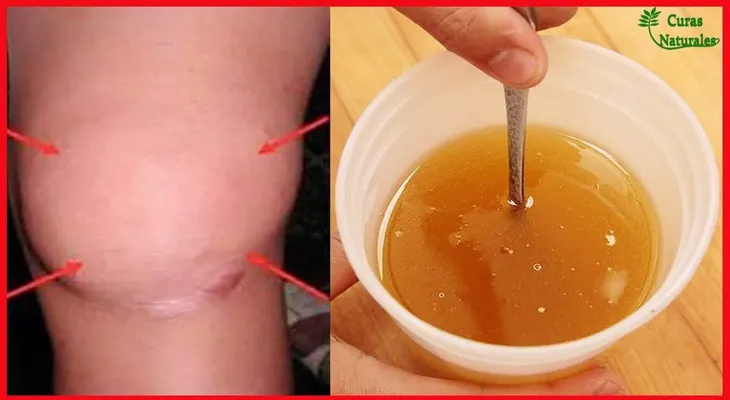La MEJOR receta que sana tus rodillas y reconstruye huesos y articulaciones 