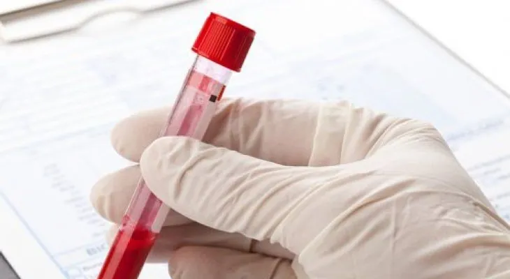 Las personas con sangre O tienen una mayor cantidad de ácidos en el estómago 