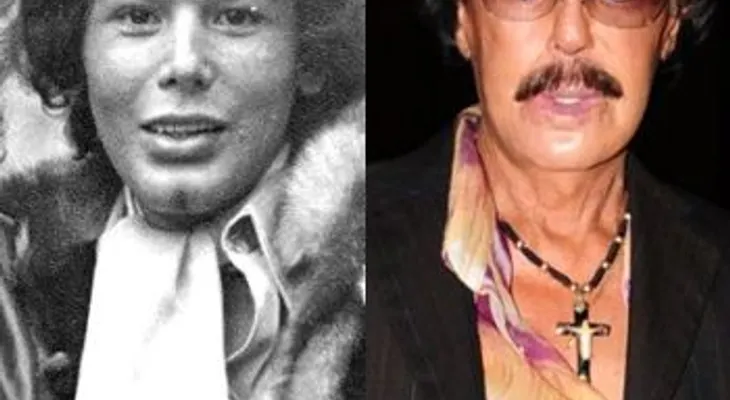 Algunos famosos que perdieron su belleza a causa de la cirugía plastica