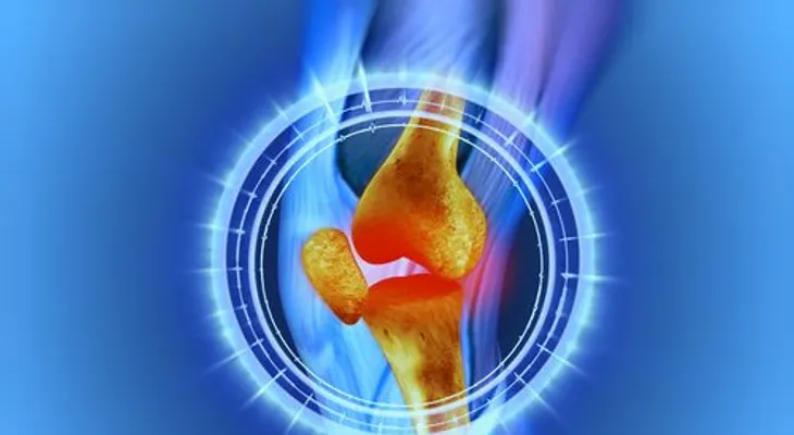 ¿Te duele la rodilla? Causas y remedios