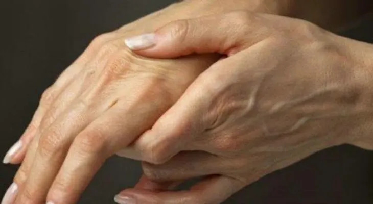 Cómo vencer la artritis reumatoide y no decaer en el intento
