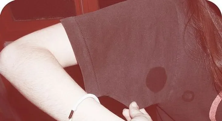 Cómo combatir la sudoración excesiva: tratamientos hiperhidrosis