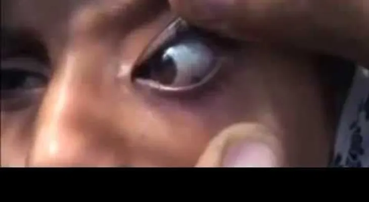El increíble caso niña llora piedras y que atribuyen a una brujería (VIDEO)