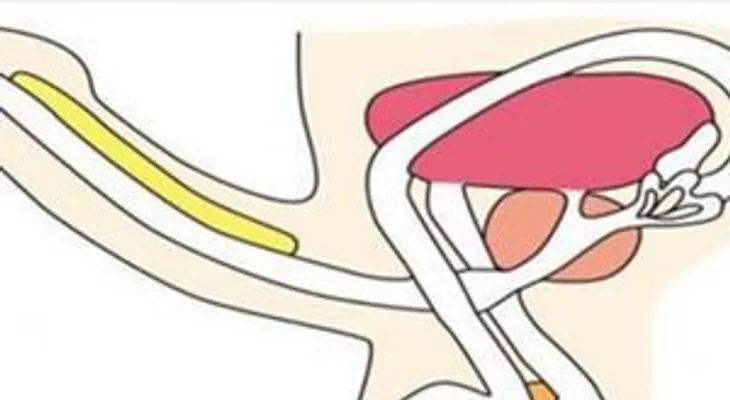 Un super remedio para acabar con tu problema de erección
