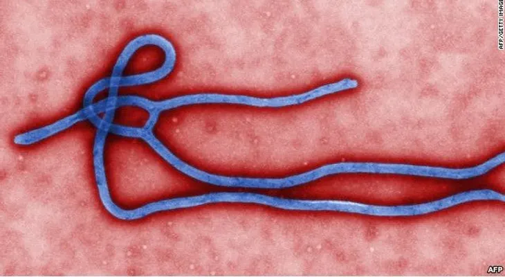 El ébola, un virus que puede viajar alrededor del mundo