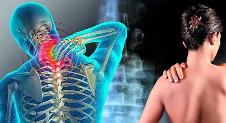 Un problema digestivo específico pordría ser causa de fibromialgia