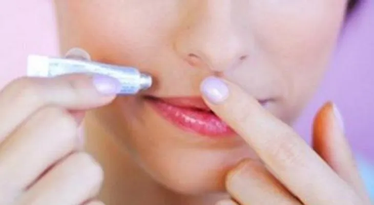 Mujer confunde pegamento con lápiz labial y se sella la boca