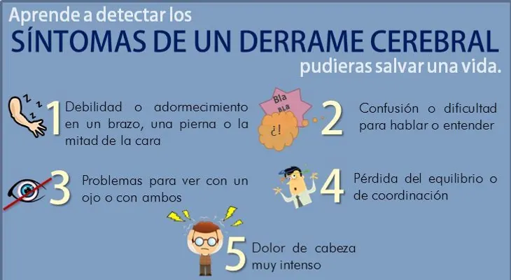 7 Síntomas para identificar derrames cerebrales en mujeres