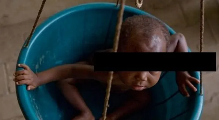 Nueve de cada 100 niños menores de 5 años en RD sufre desnutrición  