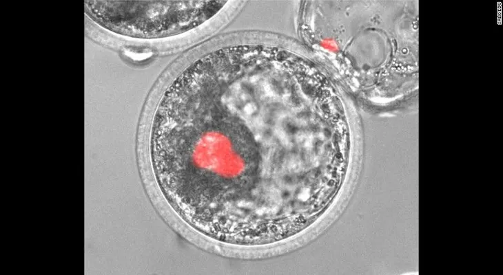 Órganos humanos cultivados en cerdos podrían ayudar a pacientes en espera de trasplantes