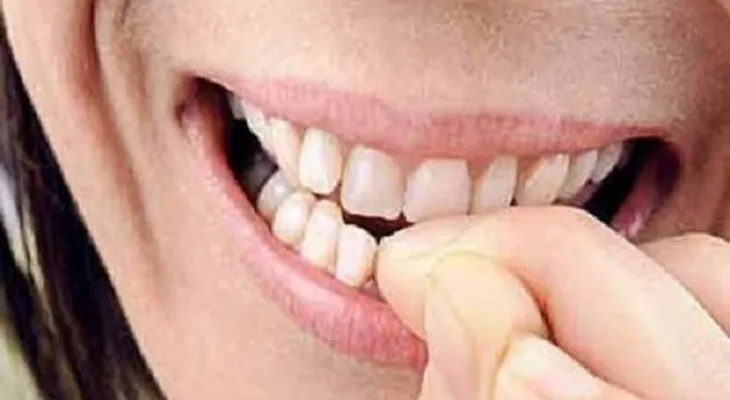 El morderse las uñas puede desencadenar en infecciones y otros daños a los dientes 