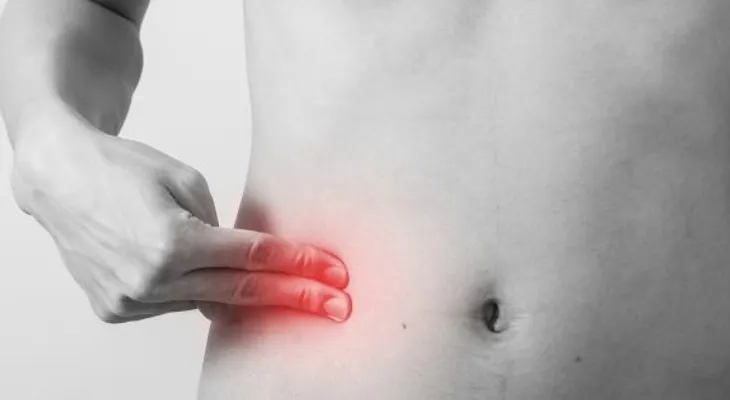 Apendicitis aguda es principal causa de abdomen agudo quirúrgico
