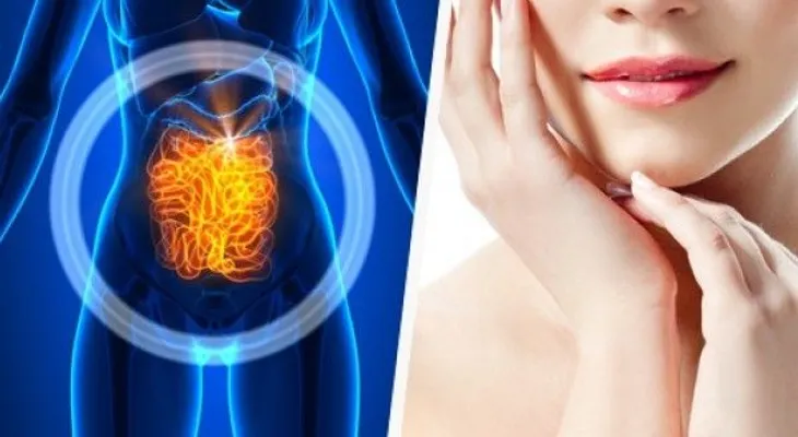 Por qué deberías sanar el intestino si quieres mejorar la piel