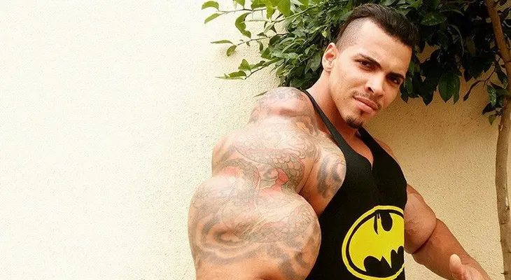 ¿Todo vale?: Así lucía el Hulk real, tras inyectarse una mezcla letal 