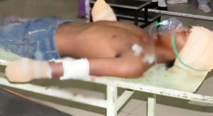 Padre le corta las manos al violador de su bebé de siete meses