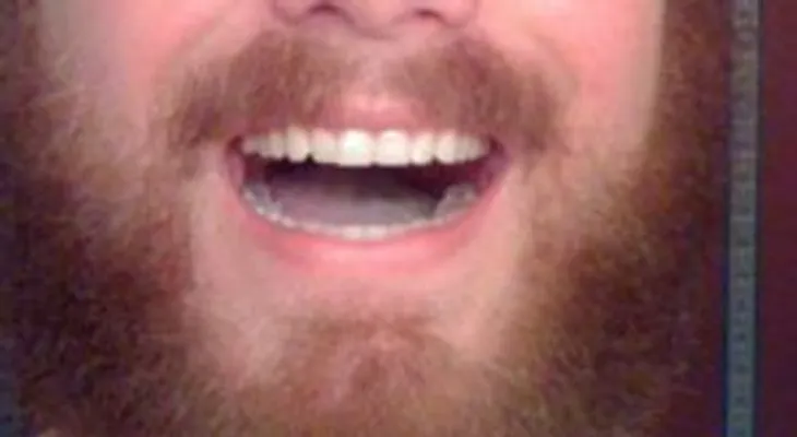 Barbas de hombres, algunas con más materia fecal que un baño