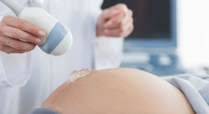 El estado de Georgia en EE.UU. prohíbe abortar si el corazón del feto late