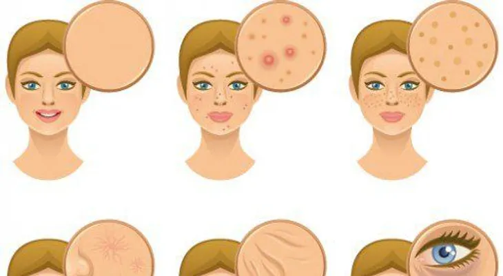 Causas de la piel seca y el acné en el rostro