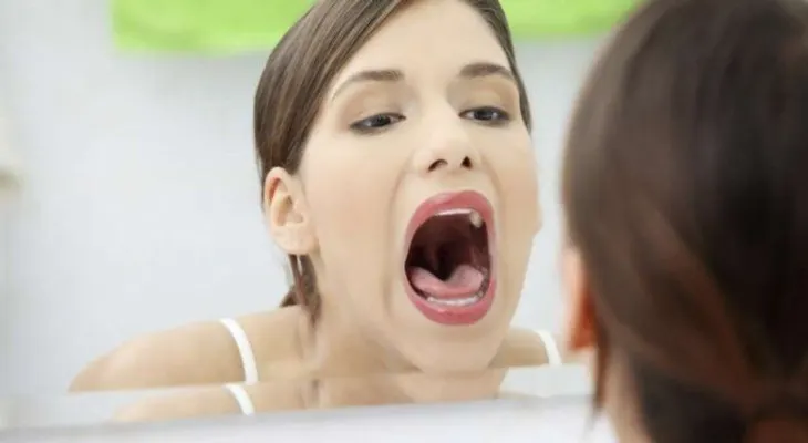 La anemia es un problema también para los dientes