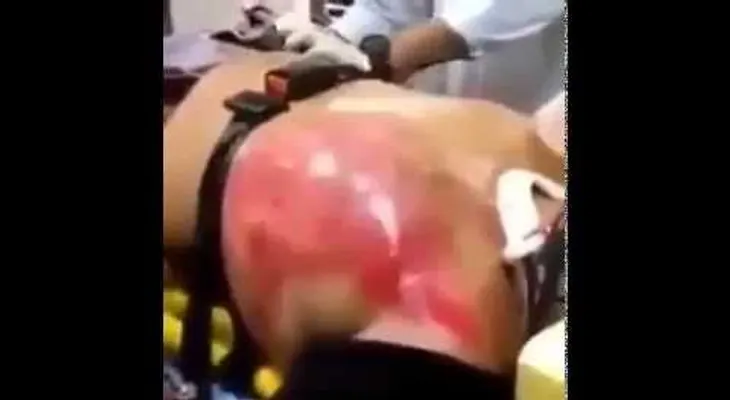 Impactante: Tomó estas 24 bebidas y su corazón iba a explotar (VIDEO)