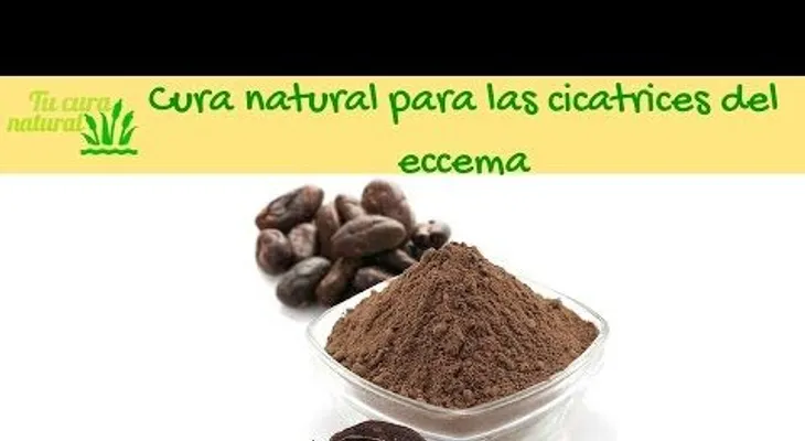 El aceite de oliva cura el ezcema (VIDEO)