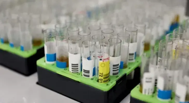 Farmacéutica pide aprobar un prometedor medicamento contra alzhéimer
