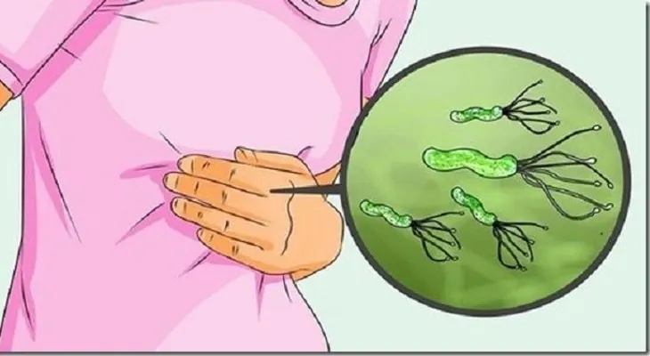 El mejor tratamiento para tener un estómago libre de la bacteria Helicobacter Pylori
