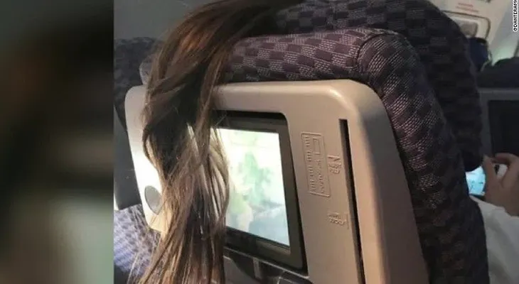 Foto de un incidente peludo en un vuelo se vuelve viral