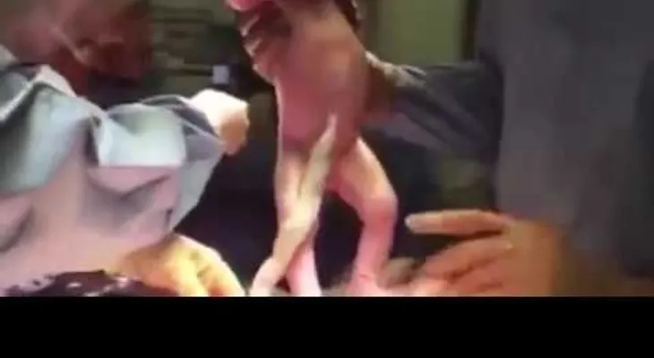 La mujer pidió que le filmaran la cesárea? (VIDEO) 