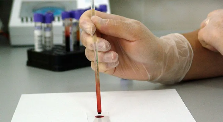  Las maneras sencillas de reducir el riesgo de contraer cáncer encontradas por científicos