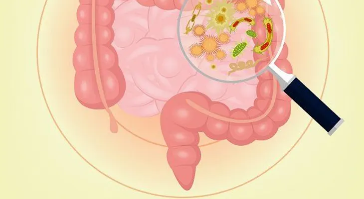 7 signos de que tus bacterias intestinales están fuera de control