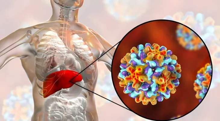 Hepatitis B y C: infecciones silenciosas que dañan el hígado sin aviso