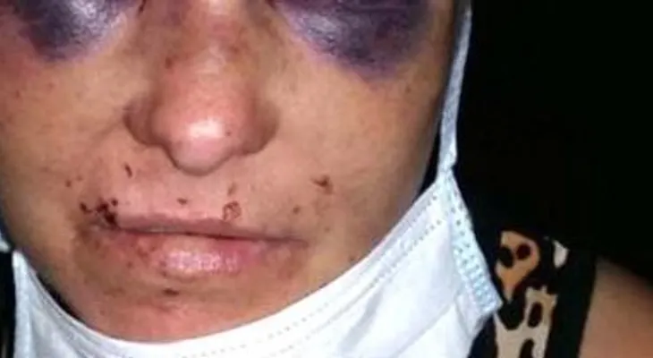 Su novio la quiso matar cuando dormía, pero se resbaló con la sangre y está viva de milagro 