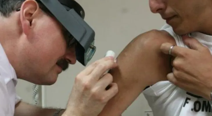 Lo que tienes que saber del cáncer de piel