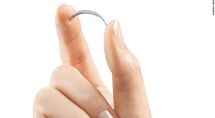 EE.UU.: Ponen bajo la lupa eficacia de método anticonceptivo Essure
