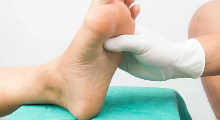 El pie diabético podrá ser tratado y prevenido: Crean nanomedicamento 