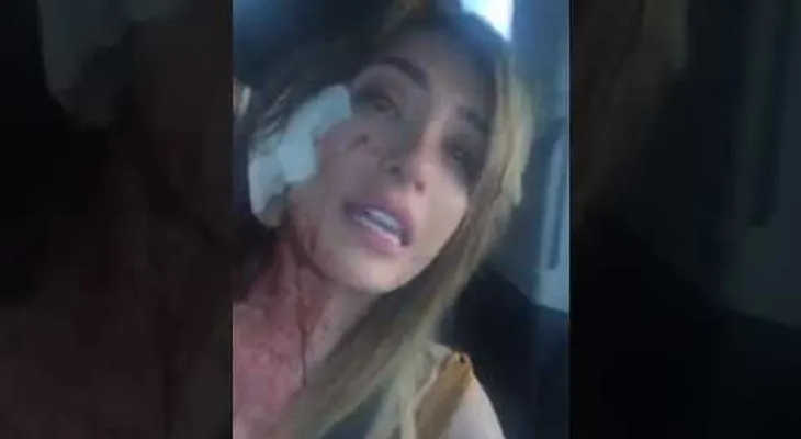 IMAGENES PUEDEN SER FUERTES: Una bailarina de "striptease" hiere con un cristal a una famosa modelo mexicana