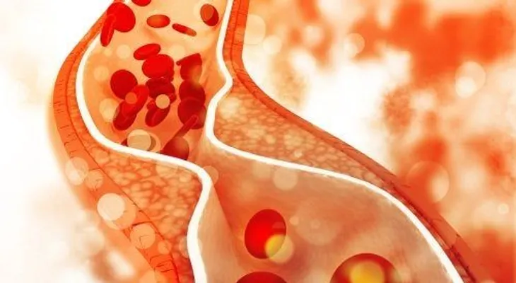 EEUU aprueba nuevo medicamento contra el colesterol y estudia vacuna para el coronavirus
