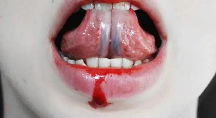 La misofonía: así se llama la furia que sientes cuando escuchas a alguien masticar 