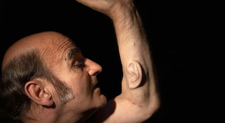 Un artista y profesor australiano cultiva una oreja en su brazo para conectarla a Internet